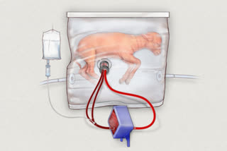 artificial womb experiment seeking FDA approval