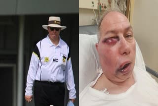 Australian umpire Tony de Nobrega  injured