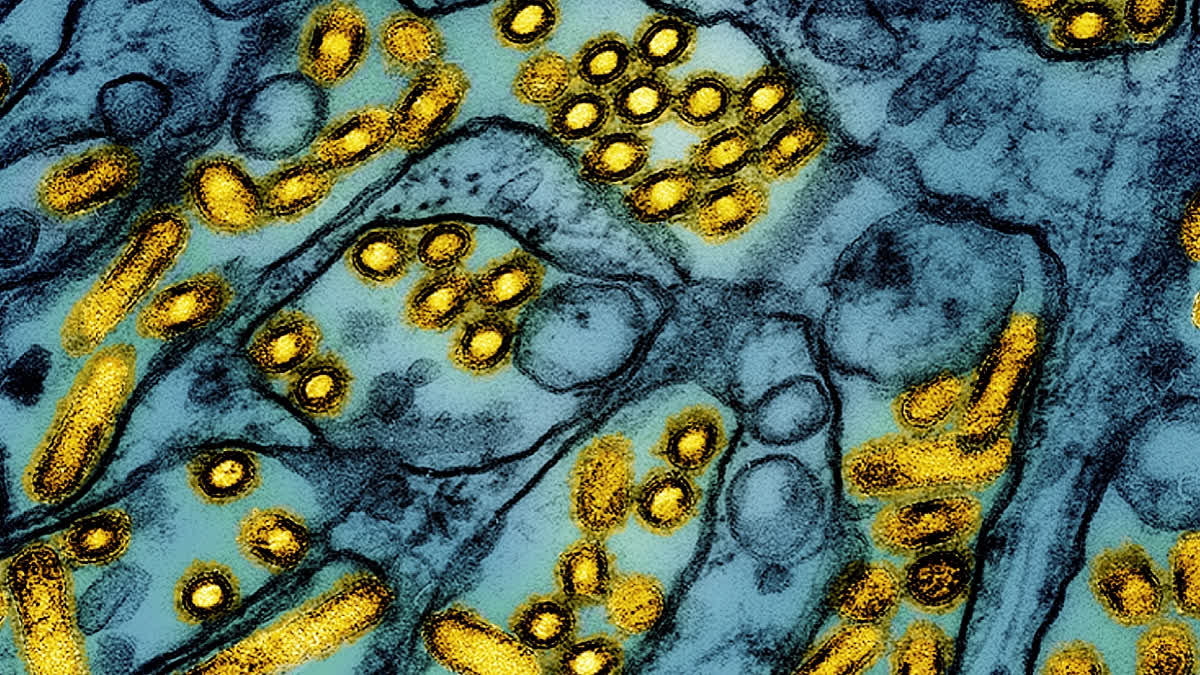 FILE -This colorized electron microscope image released by the National Institute of Allergy and Infectious Diseases on March 26, 2024, shows avian influenza A H5N1 virus particles (yellow), grown in Madin-Darby Canine Kidney (MDCK) epithelial cells (blue).