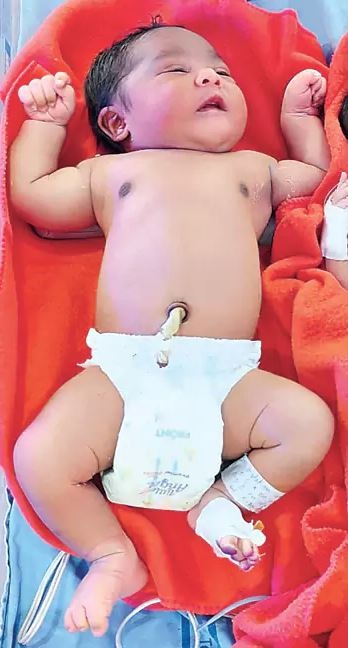 Woman Gave Birth to 5.25 Kilo Baby Boy