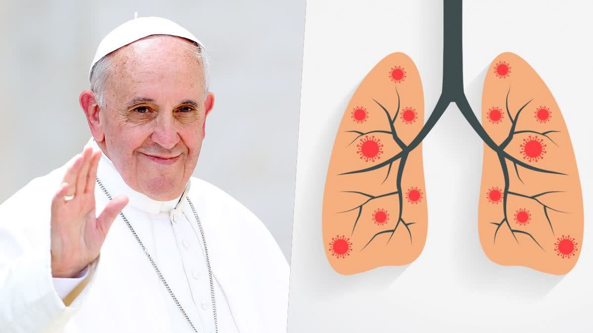 Pope Francis got double pneumonia, know how dangerous this disease is, how to avoid it?