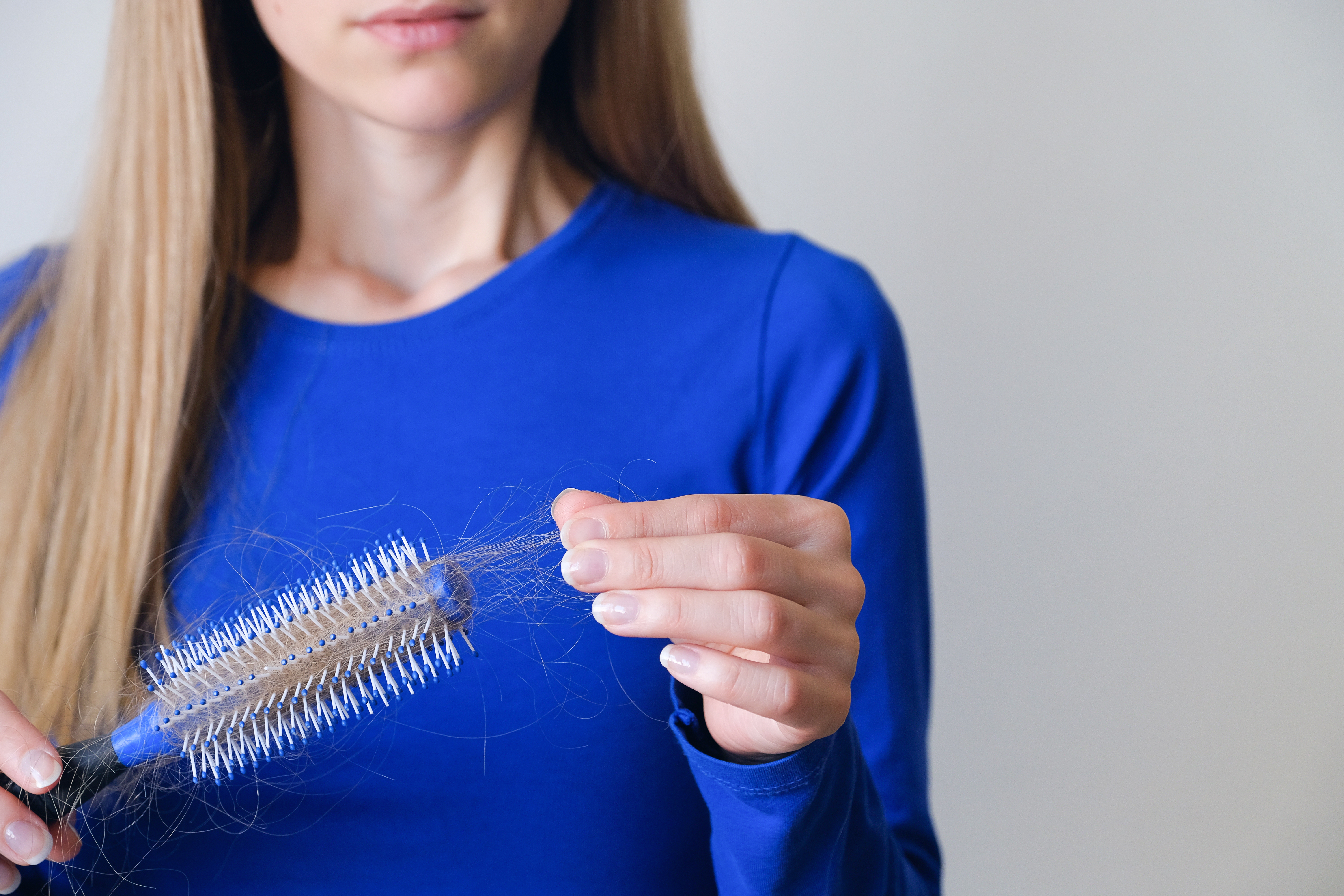 Hair Loss Remedies at Home