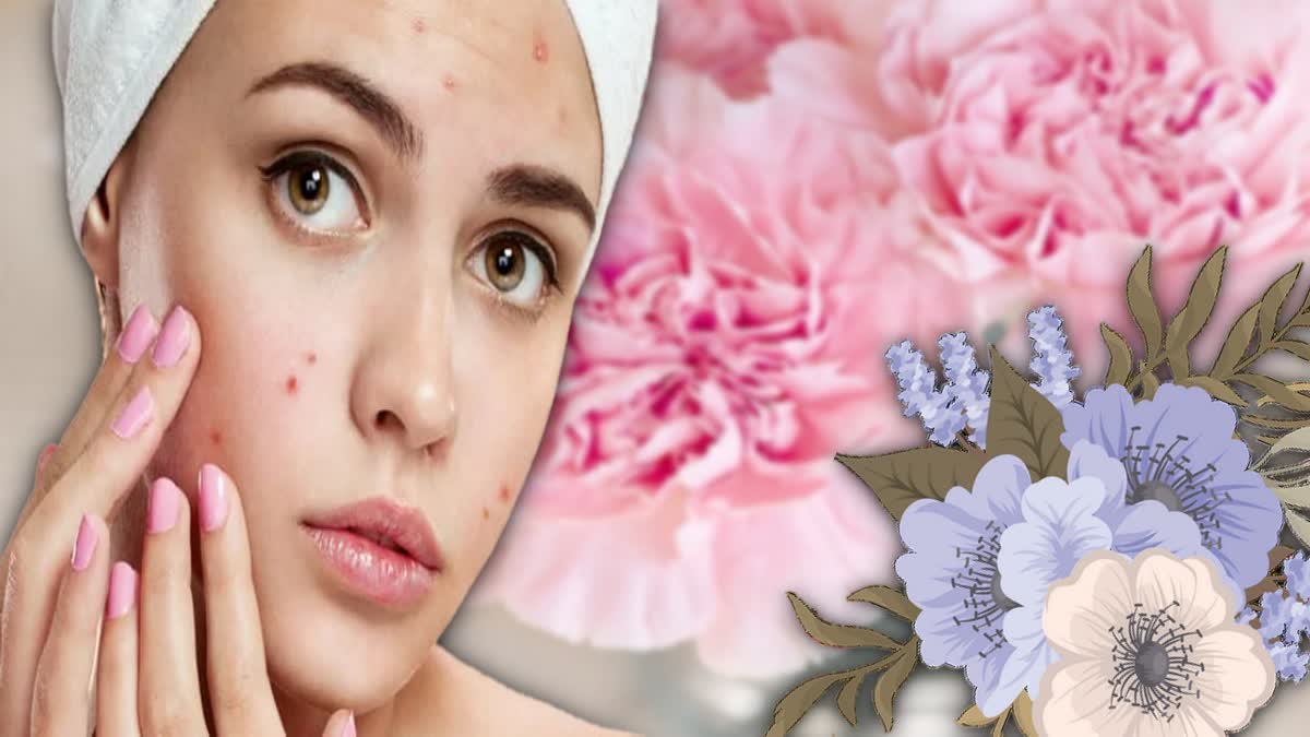 Pimples Problem News