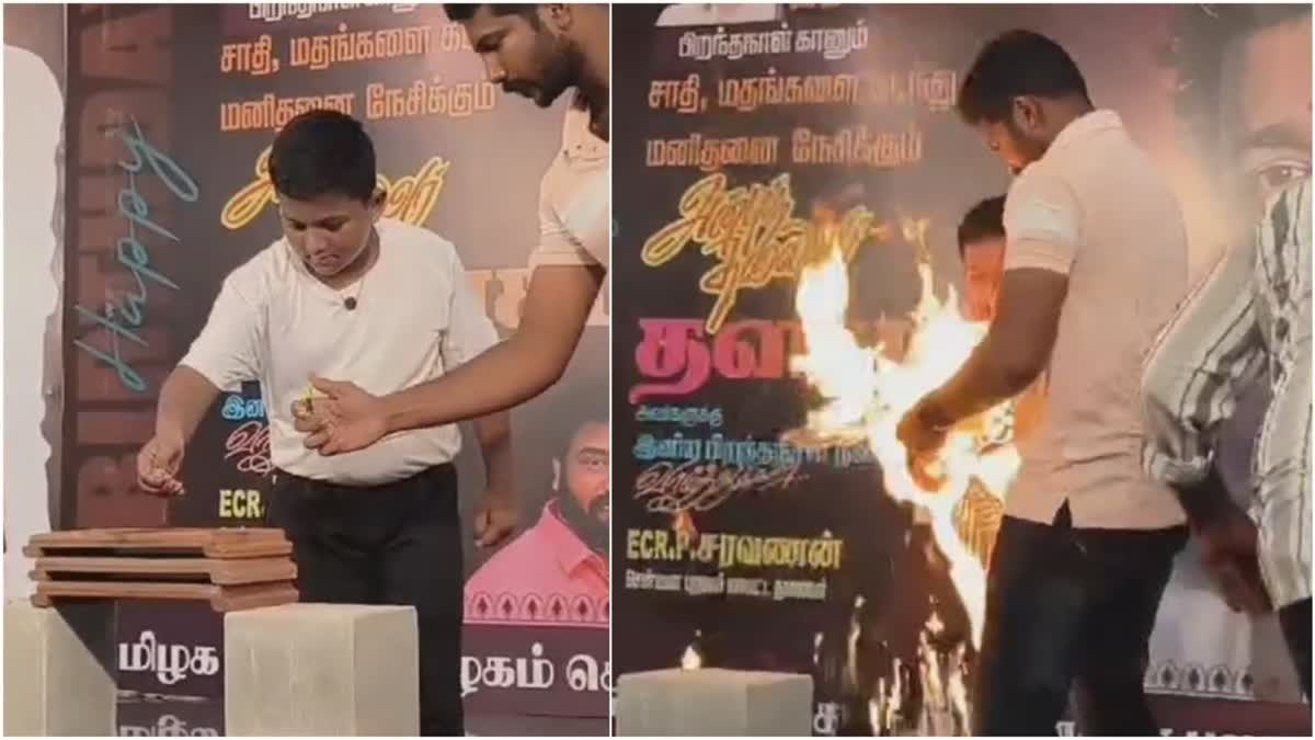 Boy Hand Catches Fire At Vijay Birthday