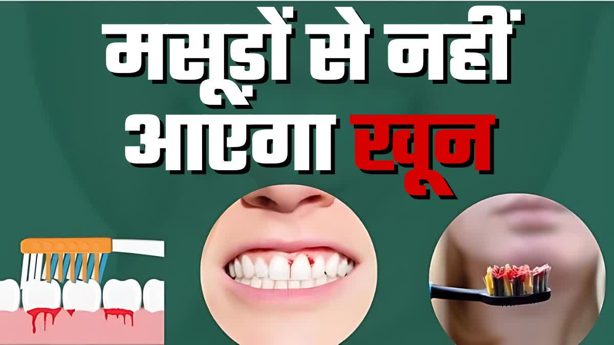 मसूड़ों से खून आने से कैसे रोकें