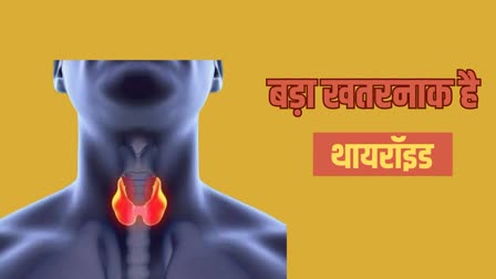 THYROID TREATMENT IN AYURVEDA