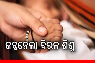 MP: ଜନ୍ମନେଲା ବିରଳ ଶିଶୁକନ୍ୟା, ରହିଛି 4ଟି ଗୋଡ