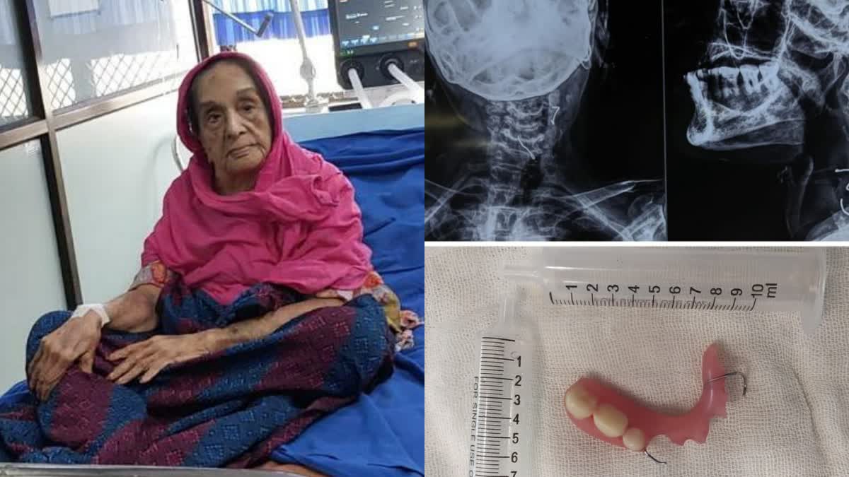 old-woman-has-swallowed-her-teeth-while-eating-chennai-govt-hospital-doctors-who-acted-quickly