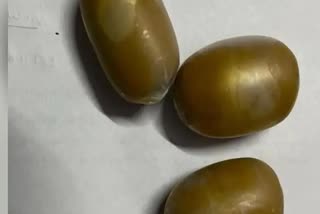 Gold capsules recovered from the rectum of a passenger at Varanasi Airport