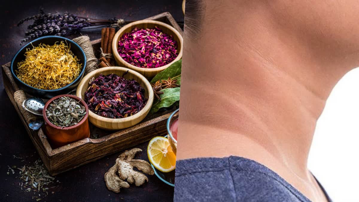 Tanning on the neck will go away, just try these home remedies