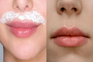 Upper Lips Hair Removal