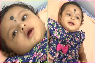 Child Suffering With Rare Disease Needs Help