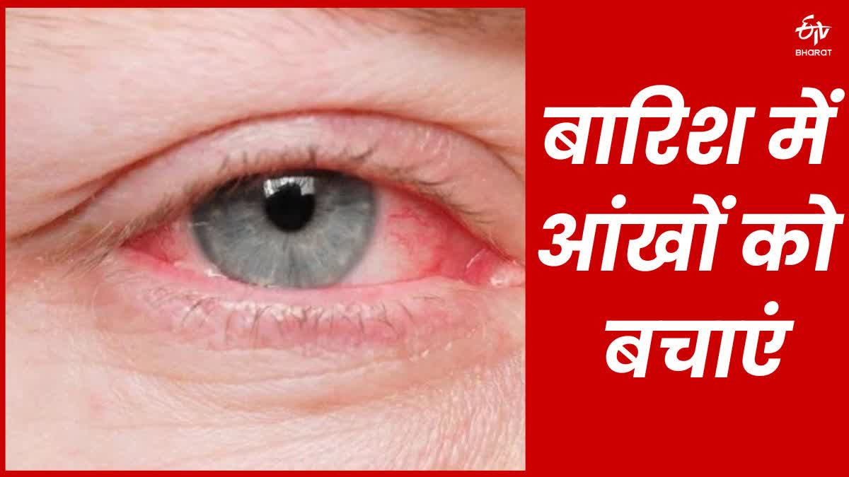 Conjunctivitis symptoms and prevention