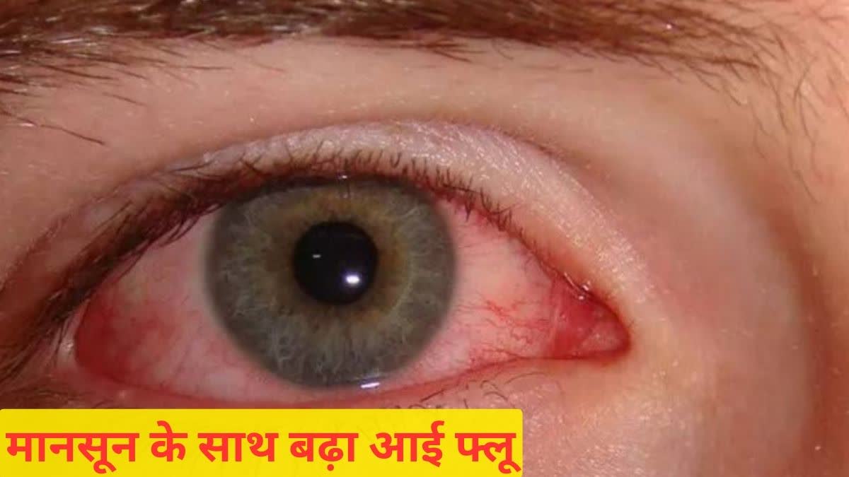 Eye Flu Cases Increased In Chhattisgarh