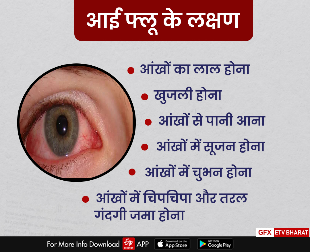symptoms of eye flu