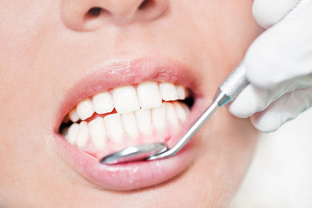 Tips For Dental Care