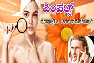 ACNE REASON SYMPTOMS ON BODY  PIMPLES SYMPTOMS ON BODY  PIMPLES PREVENTION TIPS  ACNE PREVENTION TIPS