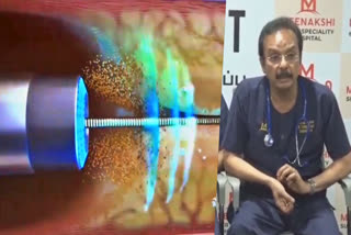 LASER ANGIOPLASTY