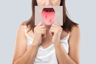 Mouth Ulcers