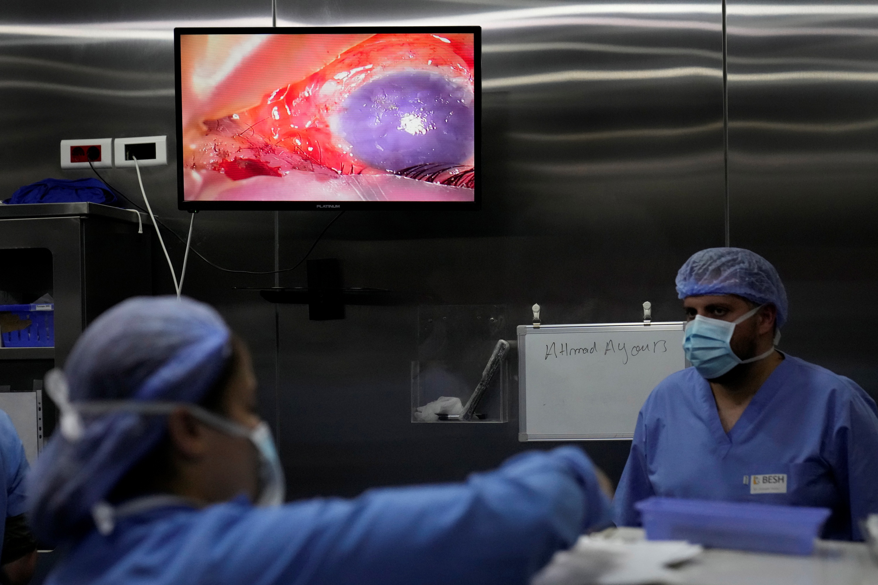 A damaged eye of a man who was injured in one of the handheld exploding devices is seen through a screen, inside an operation room during an eye surgery at the Eye Specialist hospital, in Beirut, Lebanon, Friday, Sept. 20, 2024.