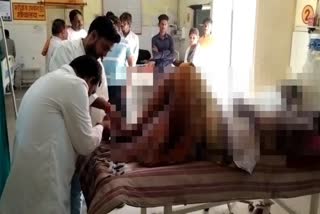 Man set on fire by woman in Rae Bareli; critical