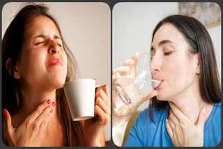 Home Remedies For Sore Throat