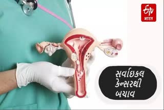 Cervical Cancer : જાણો, સર્વાઇકલ કેન્સરથી બચાવની જાણકારી આપી રહ્યાં છે નિષ્ણાત તબીબ