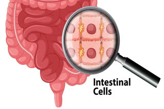 TRM cells