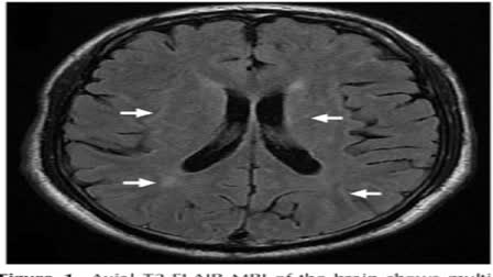 EM serious medical condition in children