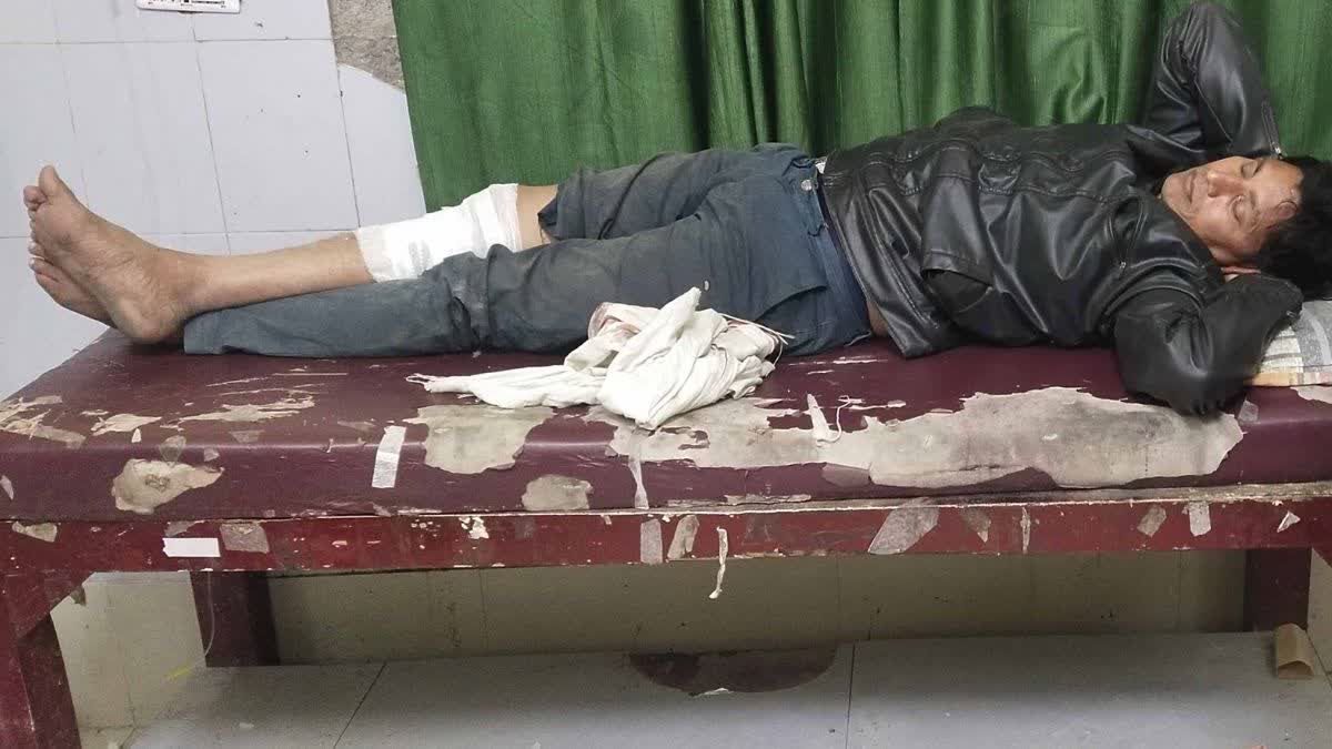 पुलिस ने मुठभेड़ में बदमाश के पैर में लगी गोली