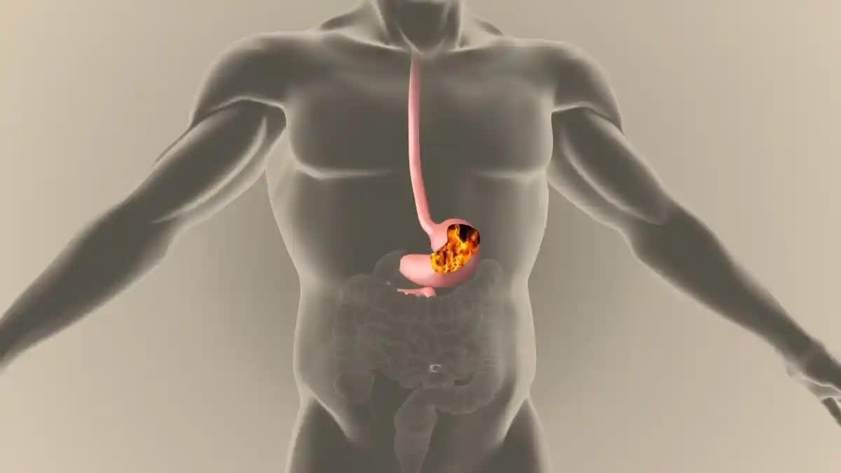 Gastric Problem Solution In Telugu