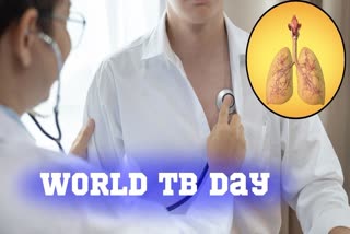 विश्व टीबी दिवस