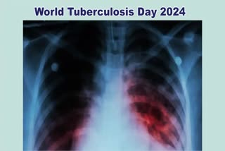 World Tuberculosis Day 2024