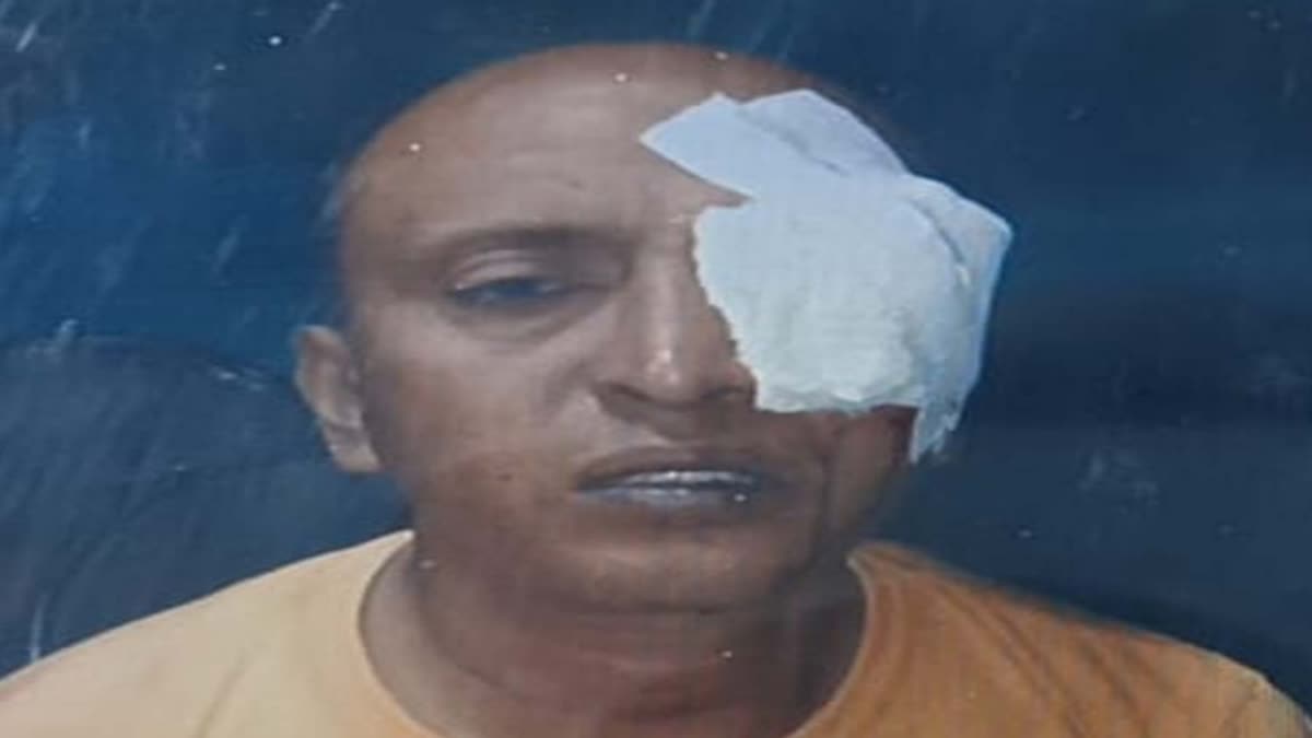 NEW BARRACKPORE MANS EYES GOUGED
