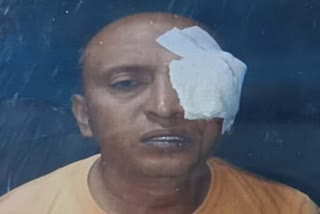 NEW BARRACKPORE MANS EYES GOUGED