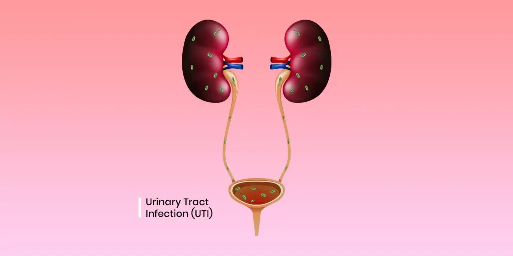 URINE TEST REQUIRED IF FEEL BURNING PAIN DURING URINATING AND WHAT IS DYSURIA