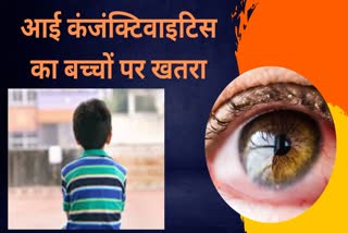 3000 children complain of conjunctivitis