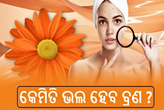 ସହଜରେ ଦୂର ହେବ ବ୍ରଣ ସମସ୍ୟା, କରନ୍ତୁ ଏହି ଉପାୟ