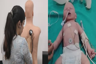 Know how Lucy, the doll made from silicone, will solve problems of millions of children