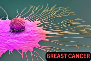 BREAST CANCER