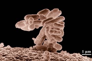 College cafeteria tables carry 60K times more bacteria than toilet seats  കോളേജ് കഫറ്റീരിയ ടേബിളുകൾ  Bacteria In College Cafeteria Tables  ബാക്‌ടീരിയ ബാധ  കഫറ്റീരിയ ടേബിളുകളേക്കാള്‍ ഭേദം ശുചിമുറികള്‍  പുതിയ പഠന റിപ്പോര്‍ട്ടുകള്‍  Colony Forming Units  ബാക്‌ടീരിയ  കോളജ് വിദ്യാര്‍ഥി  സാന്‍ഫ്രാന്‍സിസ്‌കോ  സാന്‍ഫ്രാന്‍സിസ്‌കോ വാര്‍ത്തകള്‍