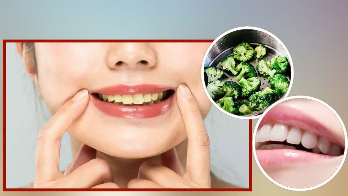 Teeth Whitening Foods