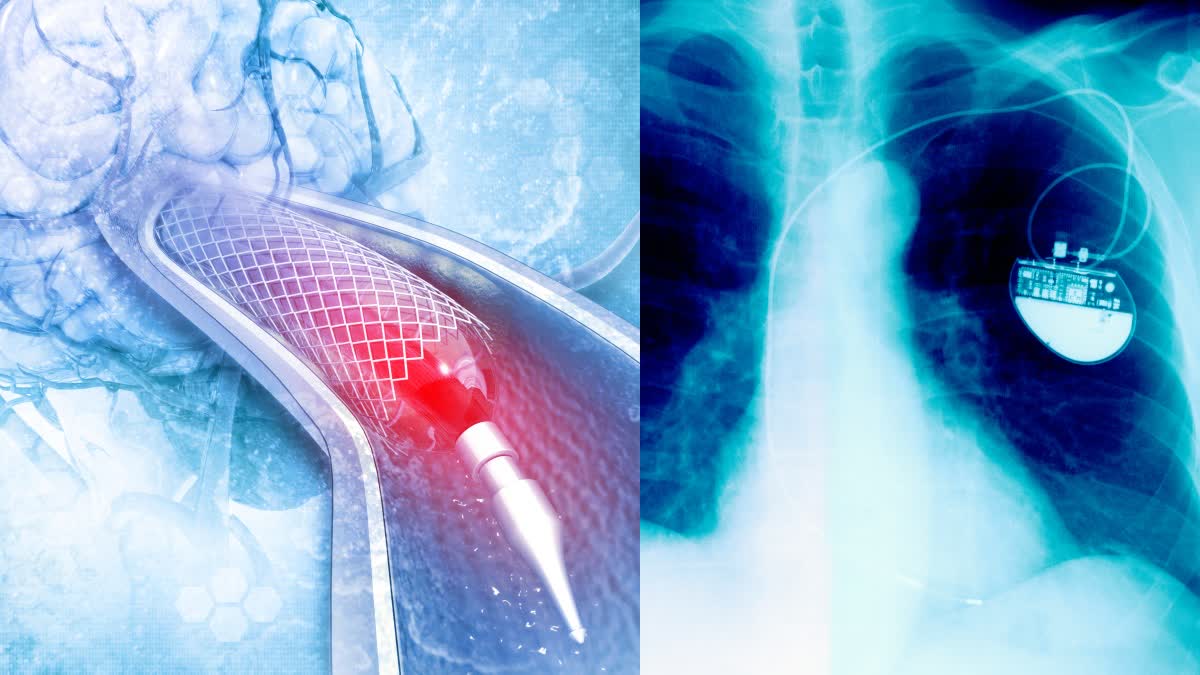 how we know stent is correct or not