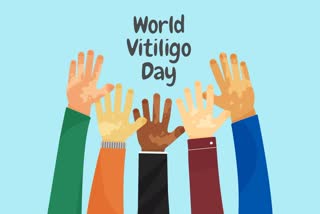 World Vitiligo Day