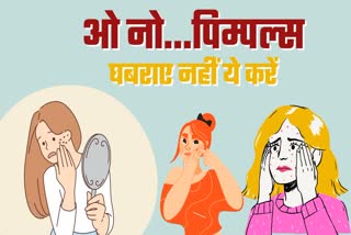 पिंपल्स से ऐसे पाएं छुटकारा