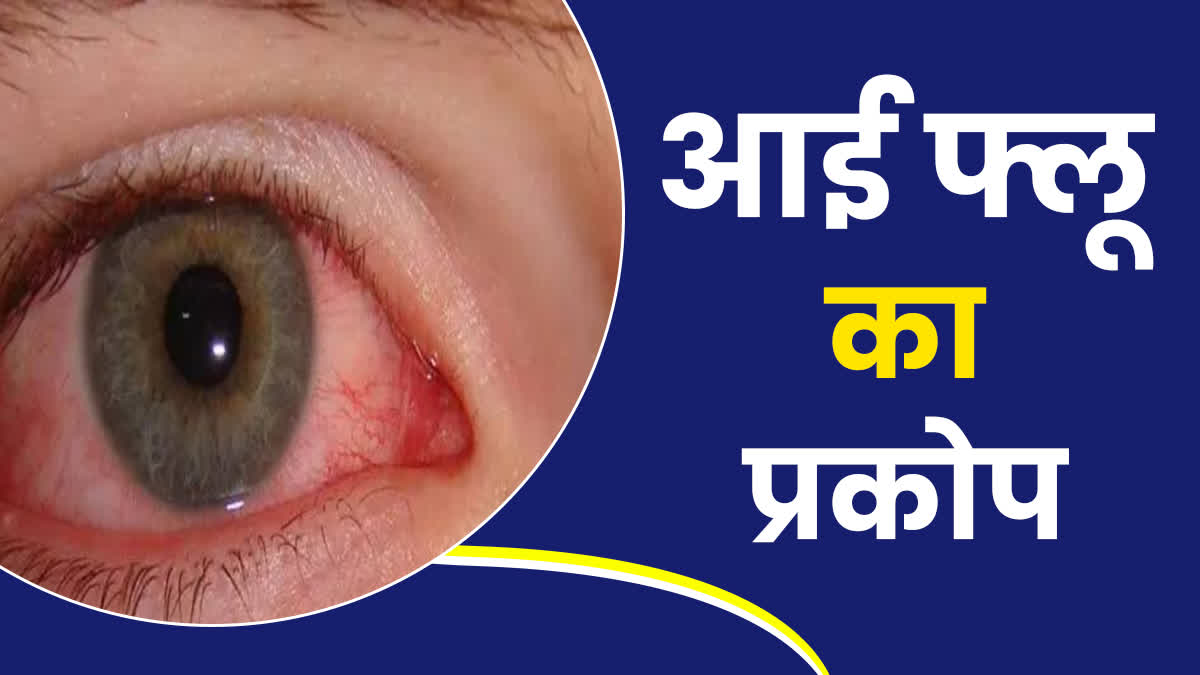 Eye Flu outbreak in Chhattisgarh