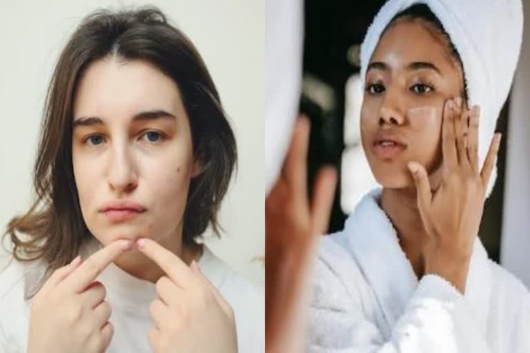 Pimples Removal Tips : మొటిమలు, మచ్చలు ఎలా తగ్గించుకోవాలి? టూత్ పేస్ట్ ...