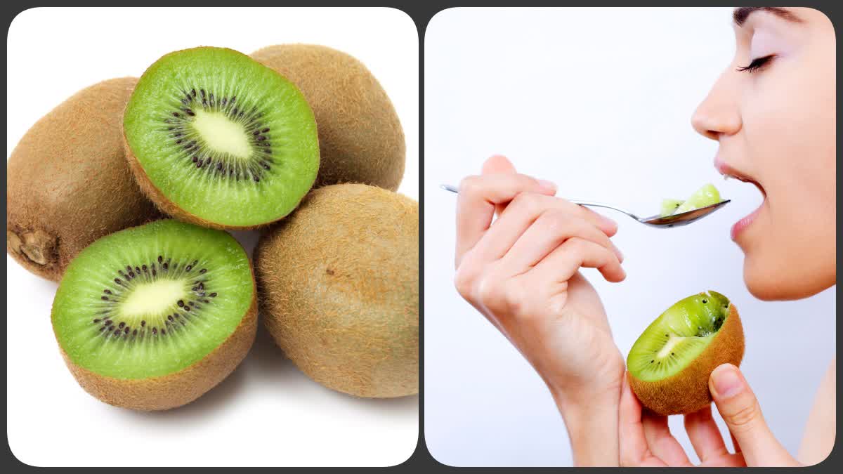 Kiwi Benefits