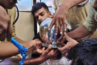 FIREFORCE HELP REMOVE HEAD FROM POT  കുട്ടിയുടെ തല പാത്രത്തിൽ കുടുങ്ങി  KOZHIKODE NEWS  LATEST NEWS IN MALAYALAM