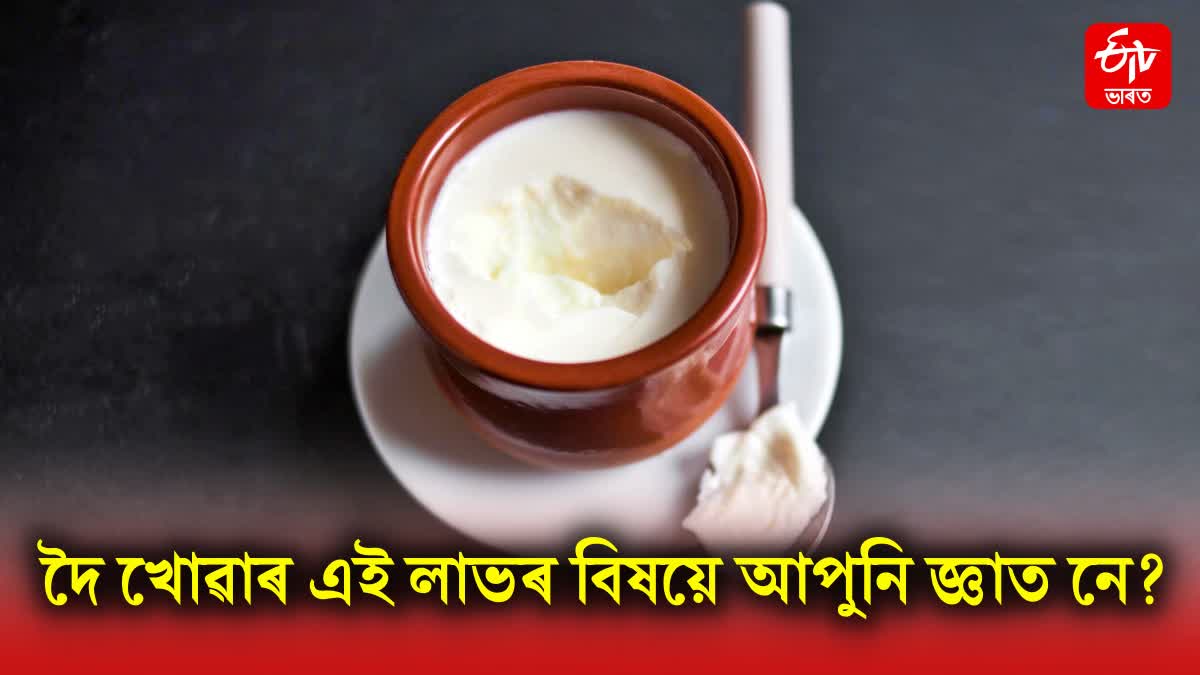 Amazing health benefits of eating curd every day